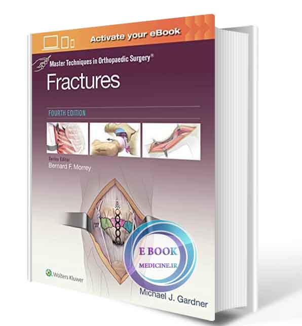 دانلود کتاب Master Techniques in Orthopaedic Surgery: Fractures Fourth 2020 ( PDF)